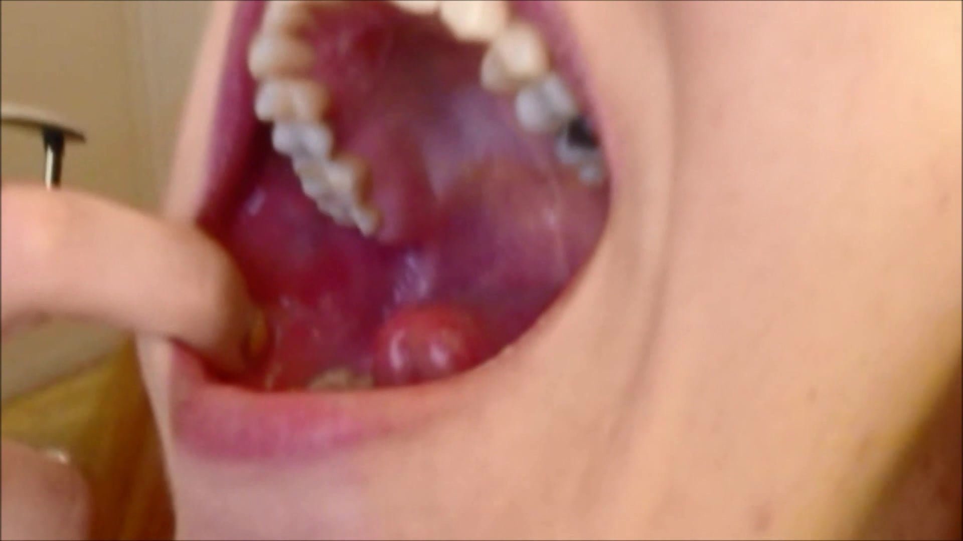 best of Uvula teeth