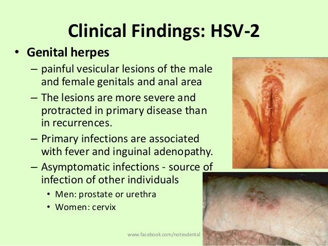 Herpes sores in the anus