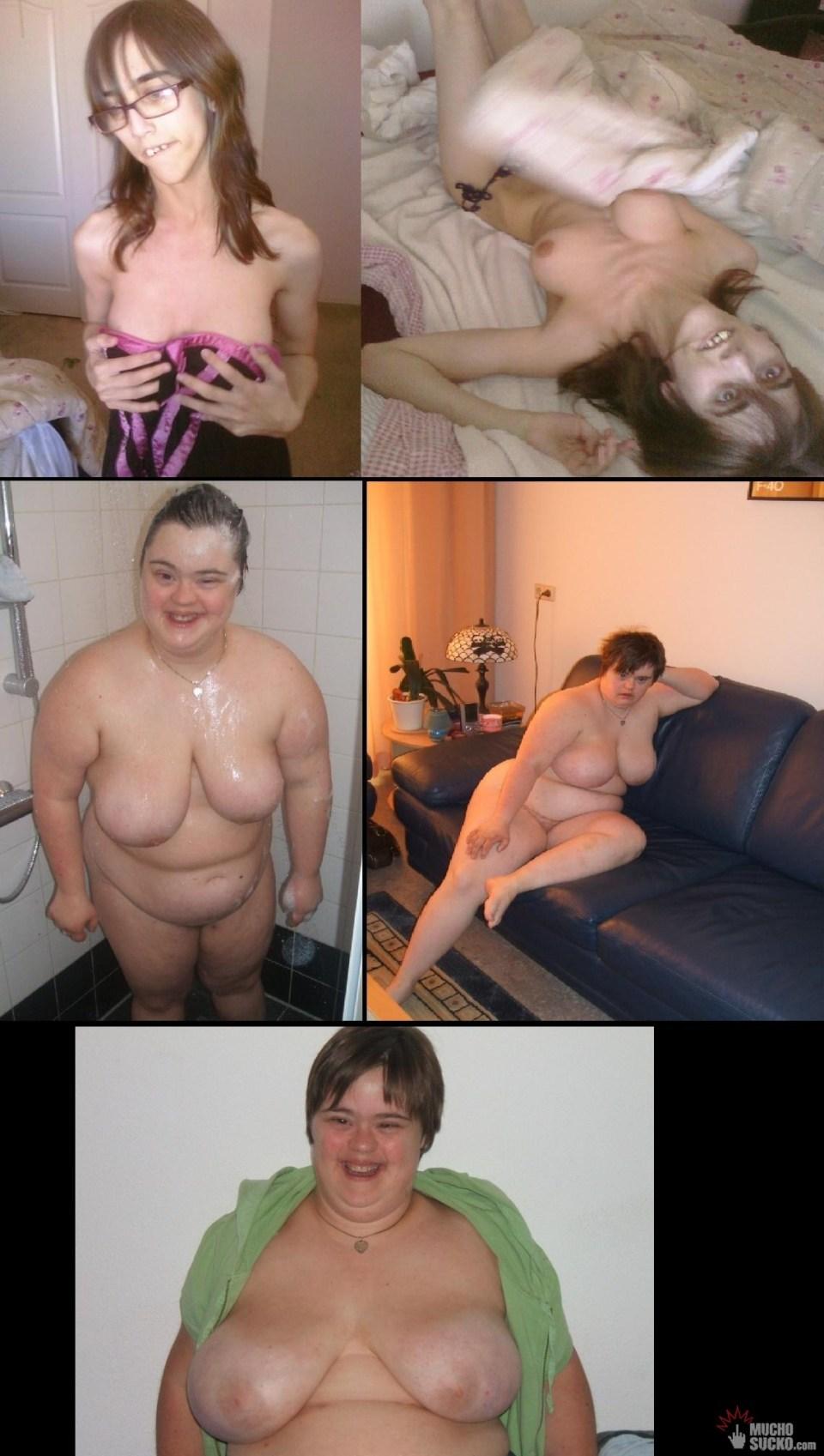 retarded nude girls ass