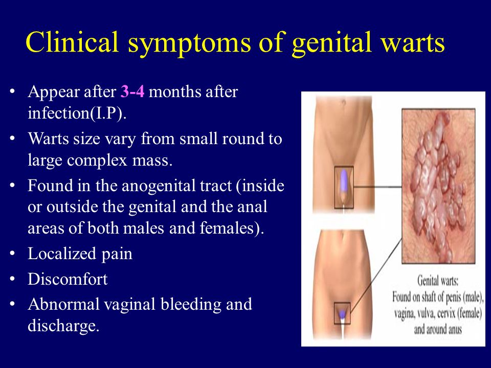 ZD reccomend Genital warts pictures on vulva