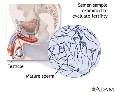 Computer assisted sperm analysis