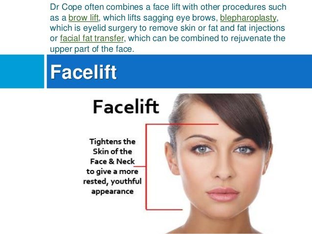 Cosmetic facial procedure