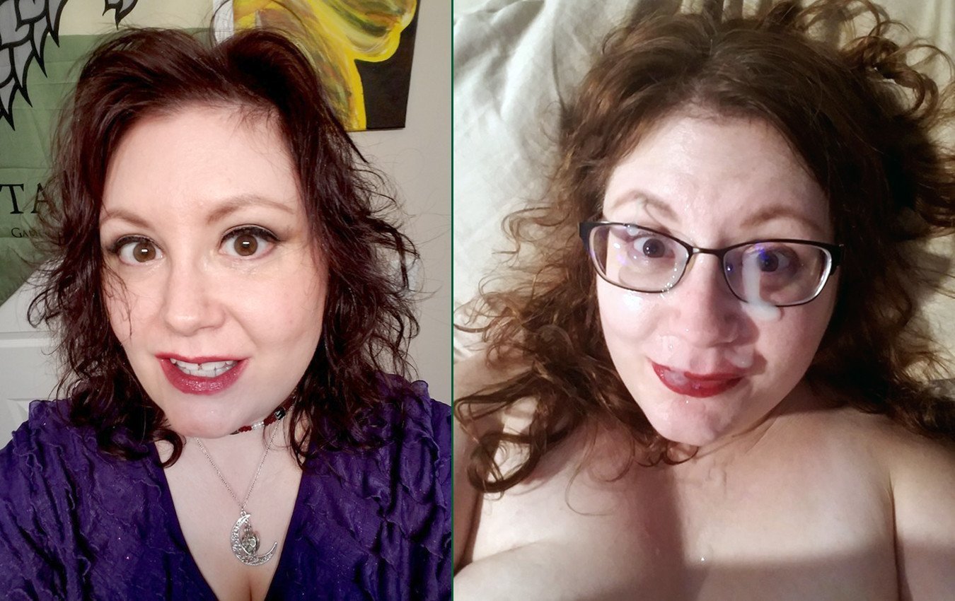 Updog recommendet before Facial and after fat