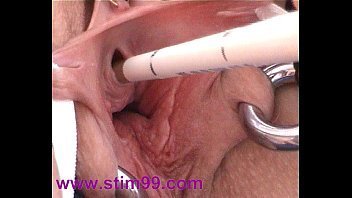 Peehole urethra